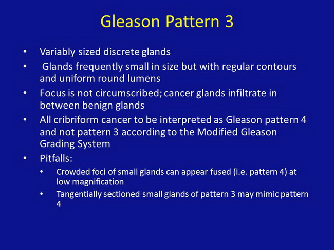 Gleason Pattern 3_Resized.jpg